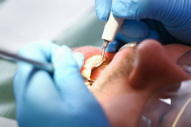 Best Emergency Dental Care for Trauma or Injury in New London, OH