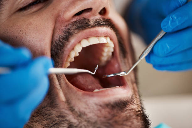 Best Walk-In Emergency Dentist in New London, OH