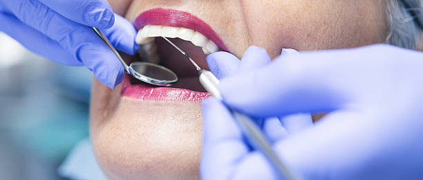 Best Walk-In Emergency Dentist in New London, OH